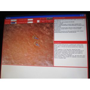 2,000,000 pixel Skin analyzer machine digital analysis software polarizing lens