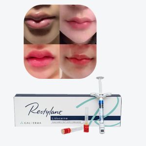 Cheap Juvederm Cross Linked Injectable Dermal Filler For Lips for sale