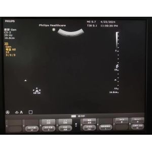 ATL Clearvue original convex array ultrasound probe C5-2