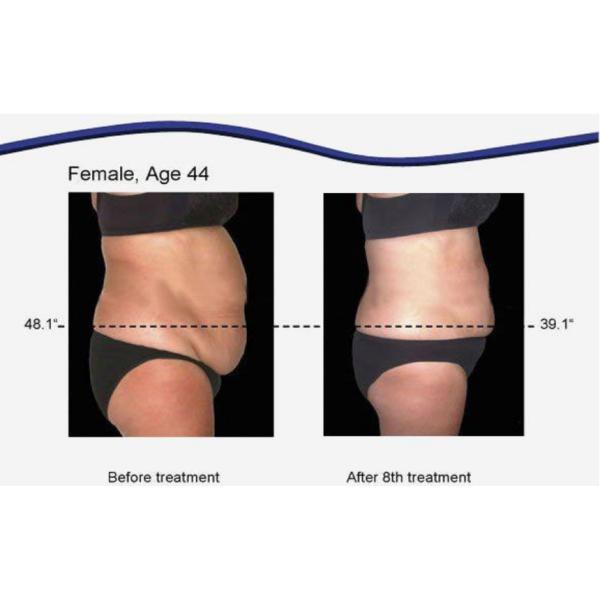 Multifunction RF Cavitation Slimming Machine , 6 In 1 Cavitation Machine