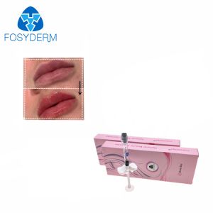 24mg Crosslinked HA For Lips Nose And Cheek