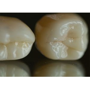 Translucent Natural Looking Zirconia dental Crown with Excellent Durability and