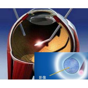 Medical Endoscope Sapphire Optical Window , 25mm Sapphire Lens Protector