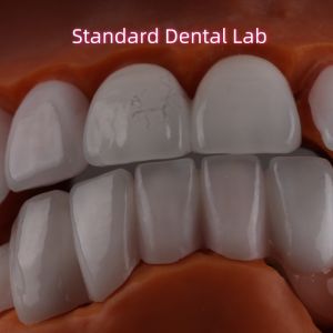 Lithium Dicilicate layer Ivoclar Emax Zirconia Laminate Veneers Translucent OEM ODM