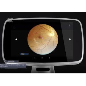 Wifi APP Digital Fundus Camera With Internal Capacity 16GB