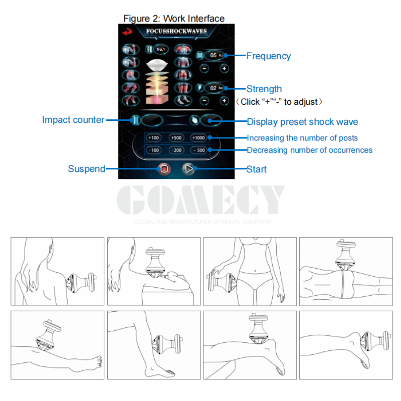 Focus Shockwave Therapy Machine Piezoelectric System for Deep Tissue Pain Relief