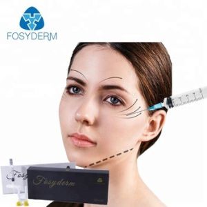 Cross Linked HA Injection Hyaluronic Acid Facial Filler For Anti Wrinkle 1ml