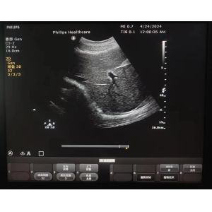 ATL Clearvue original convex array ultrasound probe C5-2