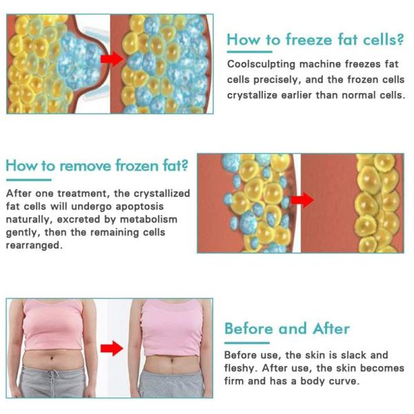 Home Use Fat Freezing Cryolipolysis Machine Cool Tech Body EMShapeing Machine