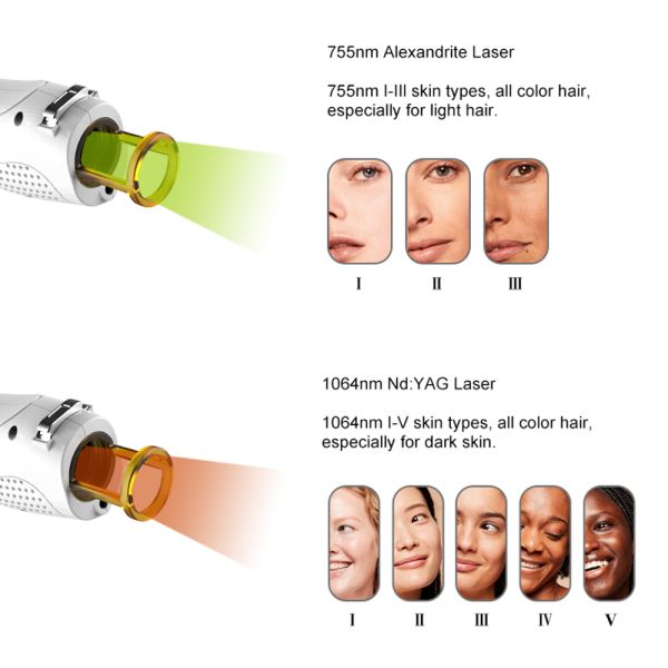 Effortless Alexandrite Laser Device Featuring User Friendly Interface and Adjustable Parameters for Custom Treatments
