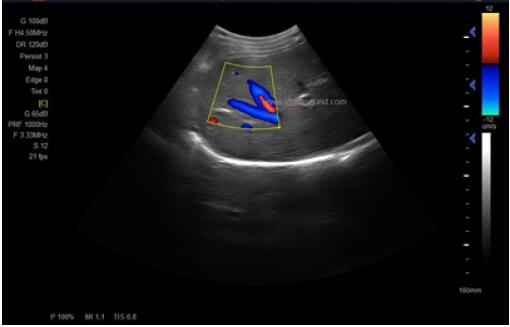 Color Doppler Ultrasound Machine Ultrasound Medical Equipment With 5 Kinds Languages