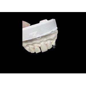 Precision-Crafted Dental Veneers Excellent Fit and High Translucency for