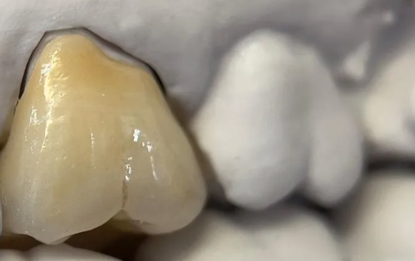 CAD CAM Dental Zirconia Block A3 22mm 1200 Mpa 57% Translucent