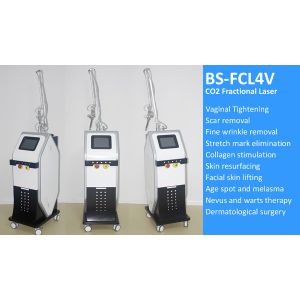Micro CO2 Fractional Laser Machine , Fractional Carbon Dioxide Laser Resurfacing