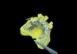 Custom Cast Partial Denture Natural Looking Solution For Enhanced Comfort And