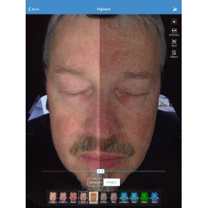 Professional Facial Skin Analysis Machine With Sharing Could Storage