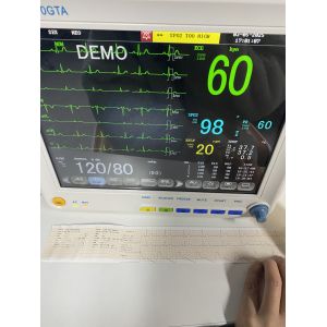 Portable Multi Parameter Patient Monitor with 12.1 Inch Display and Trolley/Wall