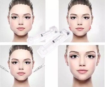 1.0ml Hyaluronic Acid Facial Filler , Injection Hyaluronic Acid Gel For Face