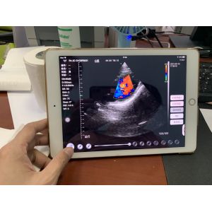 Wireless Phased Array Ultrasound Transducer Handheld Cardiac Echography Wireless