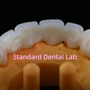 CAD CAM Mill Zirconia Crown Bridge Highly Biocompatible