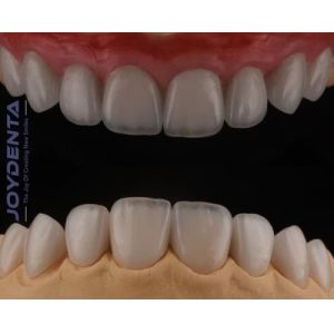 Cheap High Translucency Feldspathic Veneer , Cosmetic Porcelain Veneers With Strong Adhesion for sale