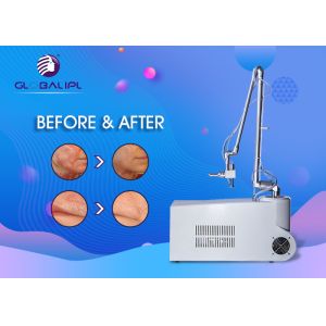 Super Pulsed CO2 Fractional Laser Machine For Face Wrinkle Removal Multifunction