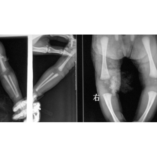 Quality Medical Dry Digital X Ray Film For Thermal Printer 11in x 14in wholesale