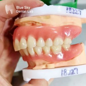 Full Arch Removable Acrylic Denture Customizable Natural Looking Denture