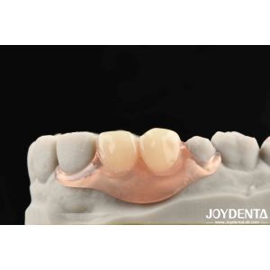 Beautiful And Harmonious Appearance Design Framework Set Up Teeth Finish