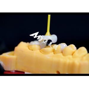 Precision Ceramic Inlays and Onlays for Teeth Repair with Natural Color