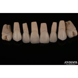 Feldspathic Natural Looking Cosmetic Veneers Precise Fit Highly Translucent