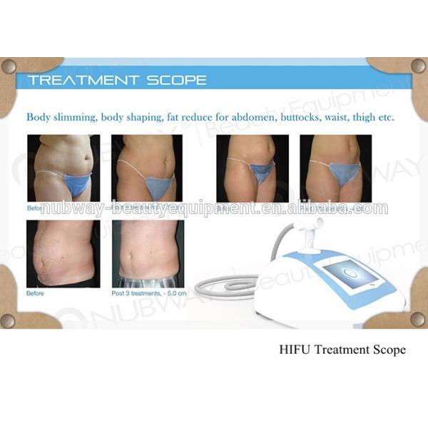 Portable HIFU slimming machine Treatment Scope.jpg