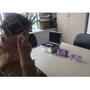 Mini Portable Digital Video Otoscope Record Photographs / Videos For Ear Nose