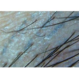 Wireless Microscope Camera Digital Video Dermatoscope Skin And Hair Analysis