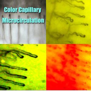 Hospital Nailfold Capillary Microscopy / Microcirculation Microscope Multi