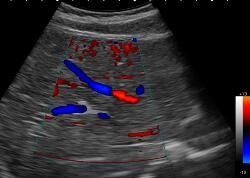 Andriod Color Doppler Ultrasound Scanner , Hand Held Doppler Machine Only 550g