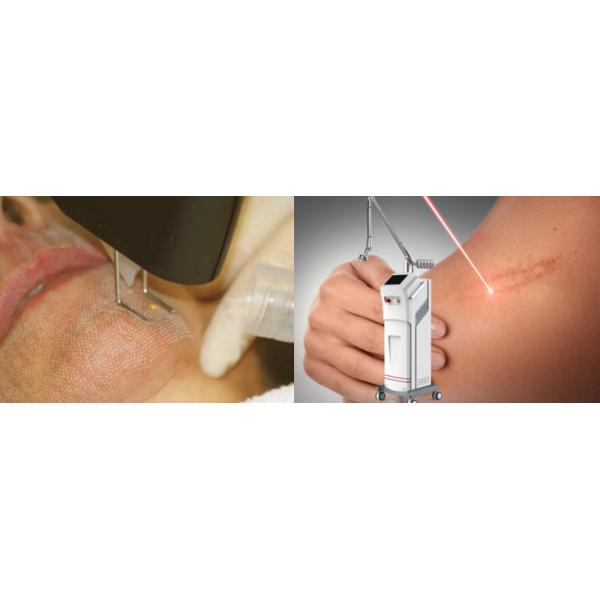 650nm Red Diode CO2 Fractional Laser Machine For Clinic Salon Random Scanning