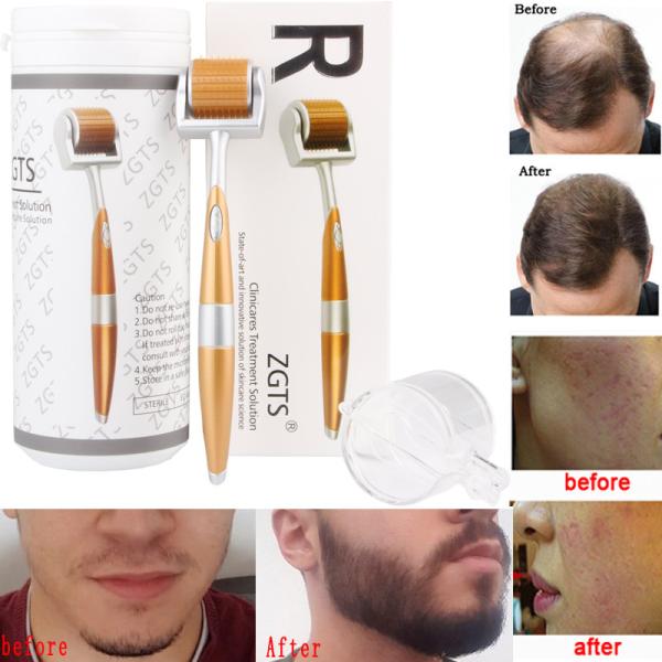 ZGTS 192 Titanium Micro Needle Derma Roller for Hair Loss Treatment anti-wrinkle dermaroller