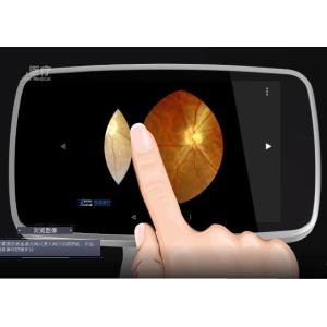 Wifi APP Digital Fundus Camera With Internal Capacity 16GB