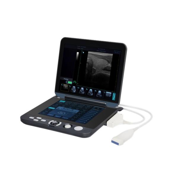 Quality 128 Images Permanent Storage Portable Digital Ultrasound Scanner with 12 Inch LED Screen wholesale
