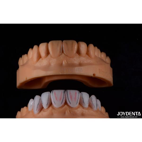 Quality Custom Made Dental Emax Ceramic Veneers With Stain Resistance High Gloss wholesale