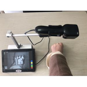 No Radiation Clear And Accurate Infrared Vein Finder With 2 Million Pixels
