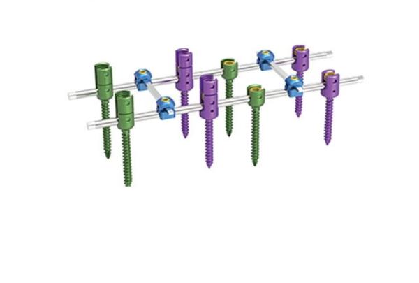 Quality Class III Spine Fixation System CNC Machining Anodizing Processing Color wholesale