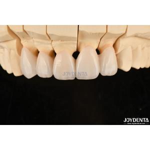 Highly Customizable Layered Zirconia Dental Crowns And Bridges Long Lasting
