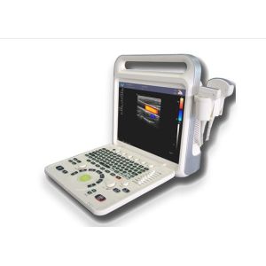 4d Ultrasound Equipment Portable Ultrasound Scanner With Phased Array Probe of
