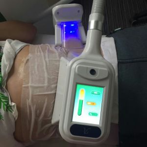 2018 Factory directly sale 10.4 inch touch screen 4 handles cryolipolysis