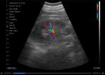 IOS Android Windows Handheld Portable Ultrasound Device Convex Linear Cardiac 3