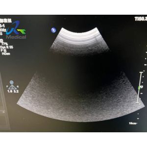 EPIQ 5 Ultrasound Machine Repair All Probe Images Are Abnormal Replace ACQ