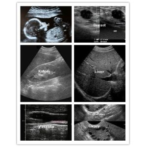 Ultrasound Scan Equipment Portable Ultrasound Scanner Ipad Ultrasound Machine