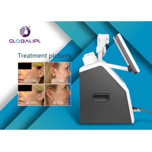 Face Lifting Wrinkle Removal HIFU Machine Belly Fat Reduce Multifunction Salon